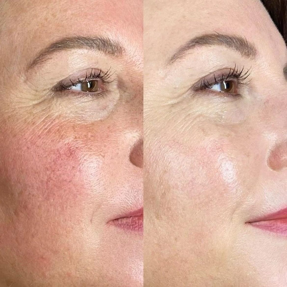 Spring Skin Prep: How to Get Your Skin Ready for Travel, Sun & a Seasonal Refresh