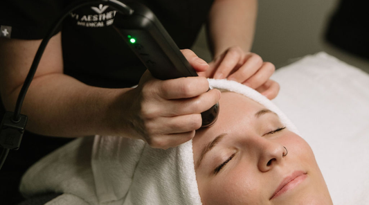 Microneedling in Charlotte: What It Does, Who It’s For & What to Expect at Avi Aesthetics