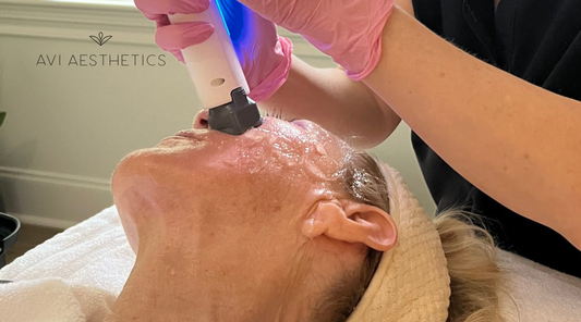 XERF at Avi Aesthetics: What to Expect From Consultation to Full Results