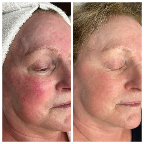Avi Aesthetics Medical Spa