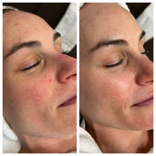 Avi Aesthetics Medical Spa