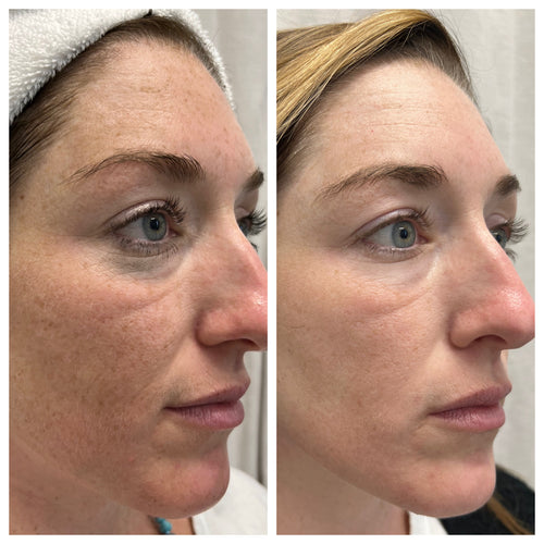 Avi Aesthetics Medical Spa